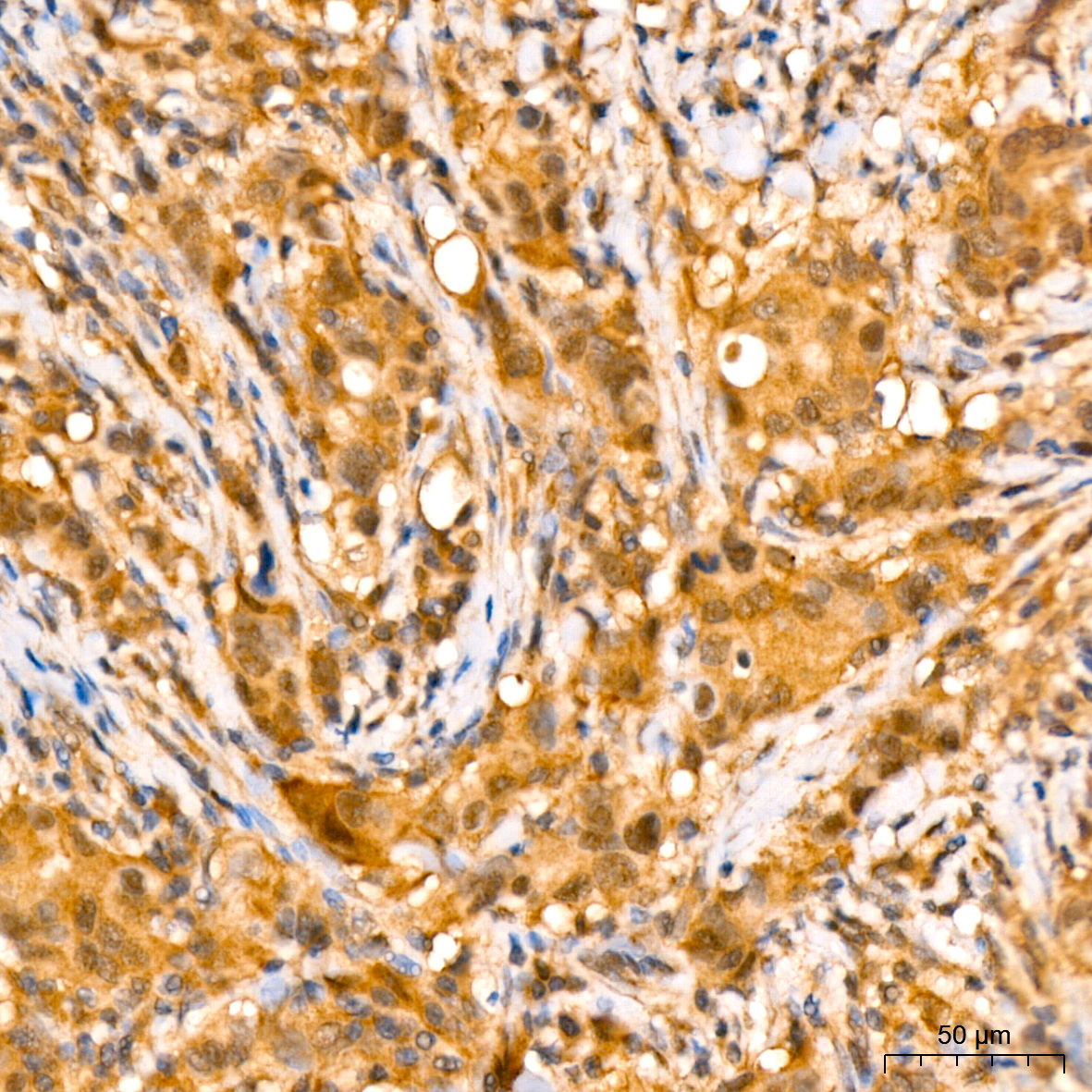 [KD Validated] eIF4EBP1 Rabbit monoclonal antibody