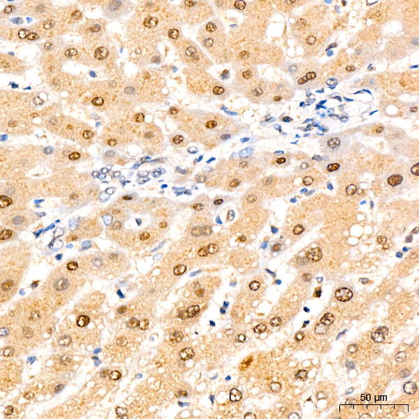 [KD Validated] eIF4EBP1 Rabbit monoclonal antibody