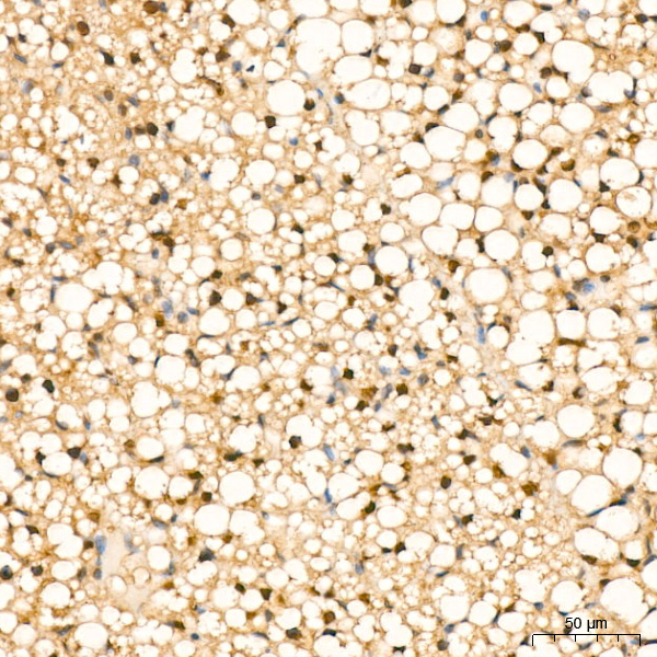 [KD Validated] eIF4EBP1 Rabbit monoclonal antibody