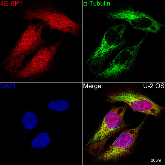 [KD Validated] eIF4EBP1 Rabbit monoclonal antibody