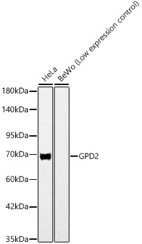 GPD2 Rabbit monoclonal antibody