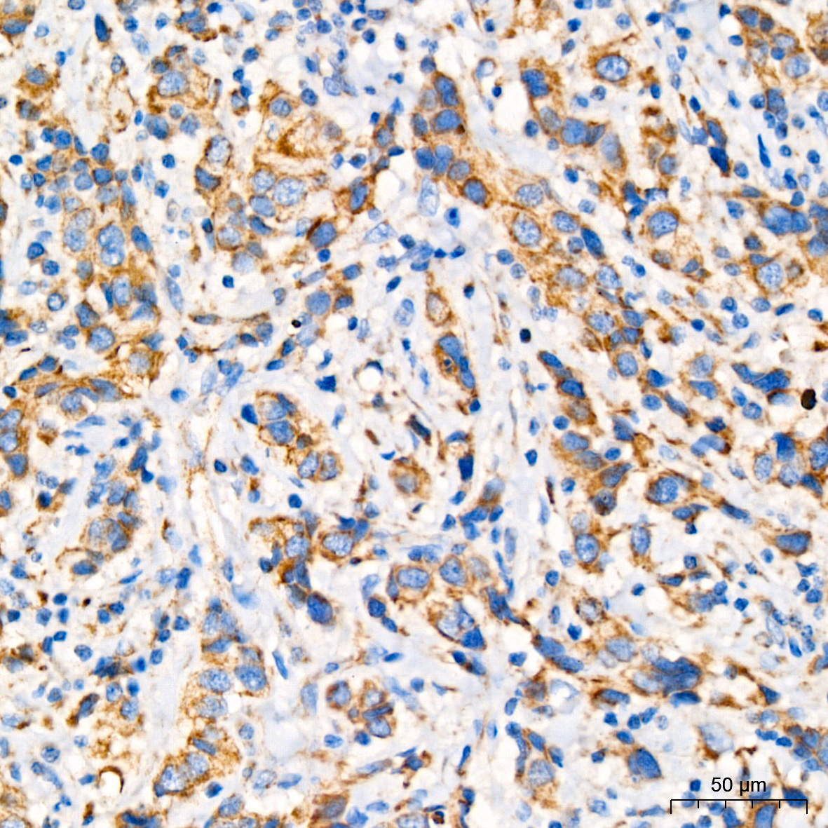 GPD2 Rabbit monoclonal antibody