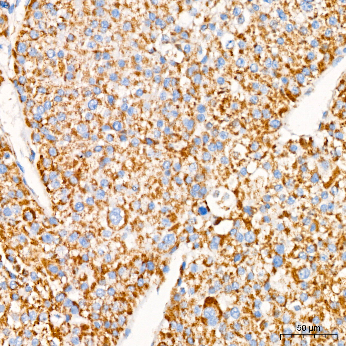 GPD2 Rabbit monoclonal antibody