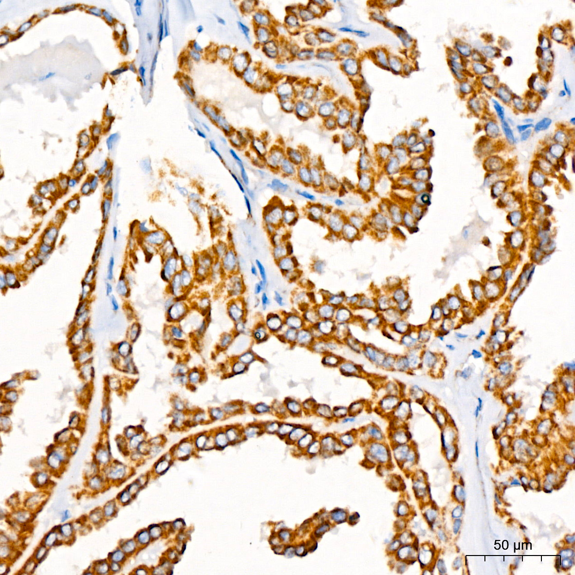 GPD2 Rabbit monoclonal antibody