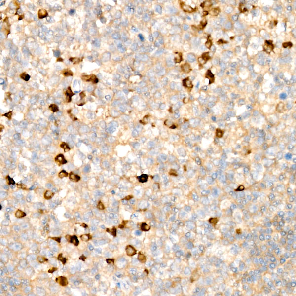Human Kappa Light Chain Rabbit monoclonal antibody
