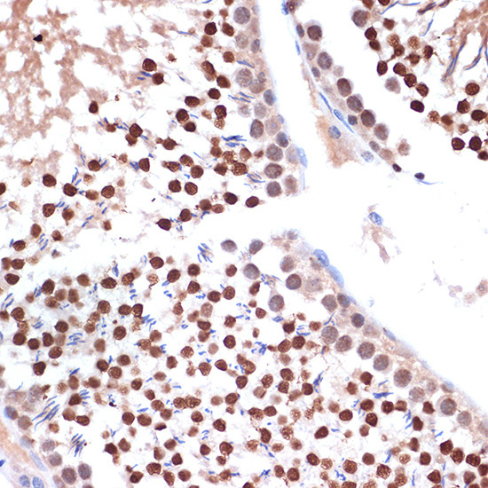 NUP153 Rabbit monoclonal antibody
