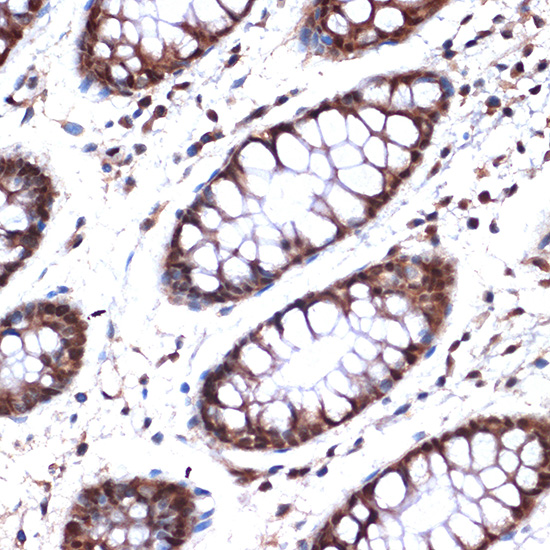 NUP153 Rabbit monoclonal antibody