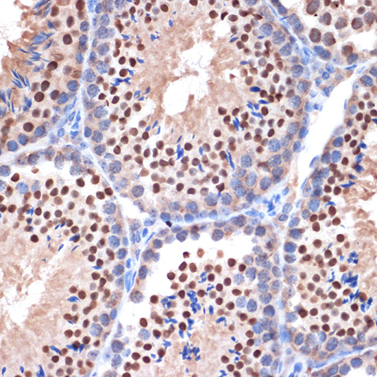 NUP153 Rabbit monoclonal antibody