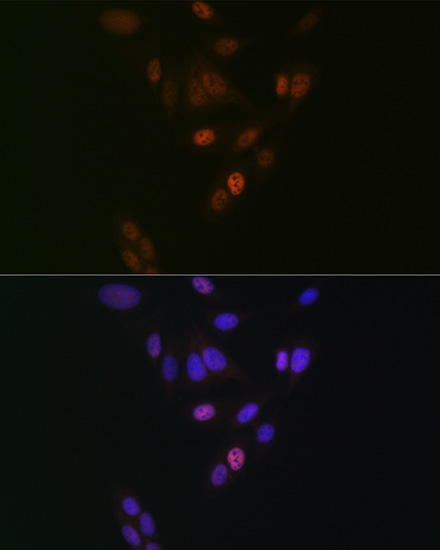 NUP153 Rabbit monoclonal antibody