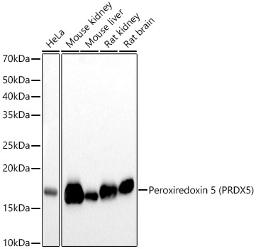 [KO Validated] Peroxiredoxin 5 (PRDX5) Rabbit monoclonal antibody