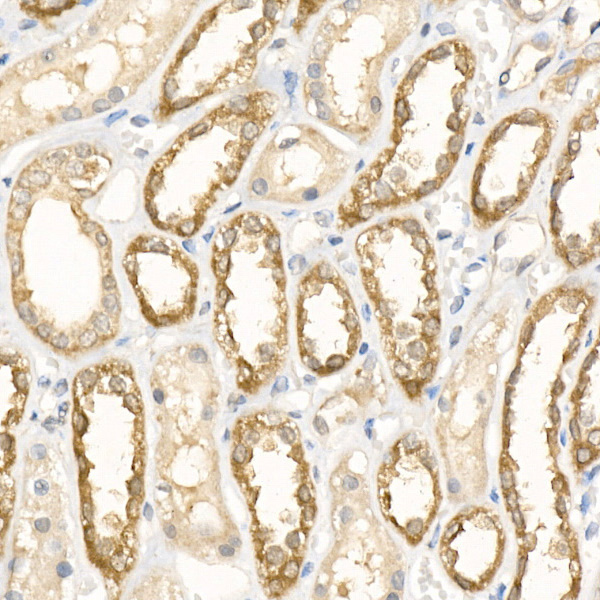 [KO Validated] Peroxiredoxin 5 (PRDX5) Rabbit monoclonal antibody