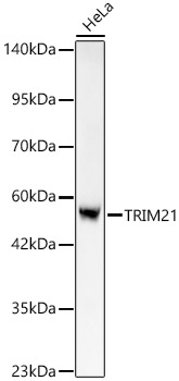 [KO Validated] TRIM21/SS-A Rabbit monoclonal antibody