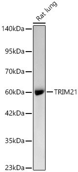 [KO Validated] TRIM21/SS-A Rabbit monoclonal antibody
