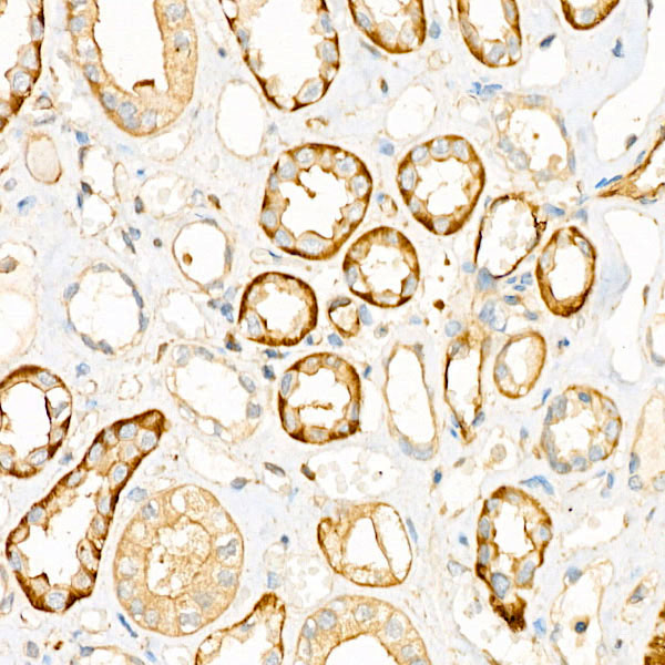 UBE2C Rabbit monoclonal antibody