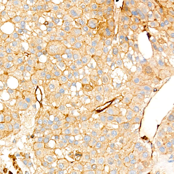 UBE2C Rabbit monoclonal antibody