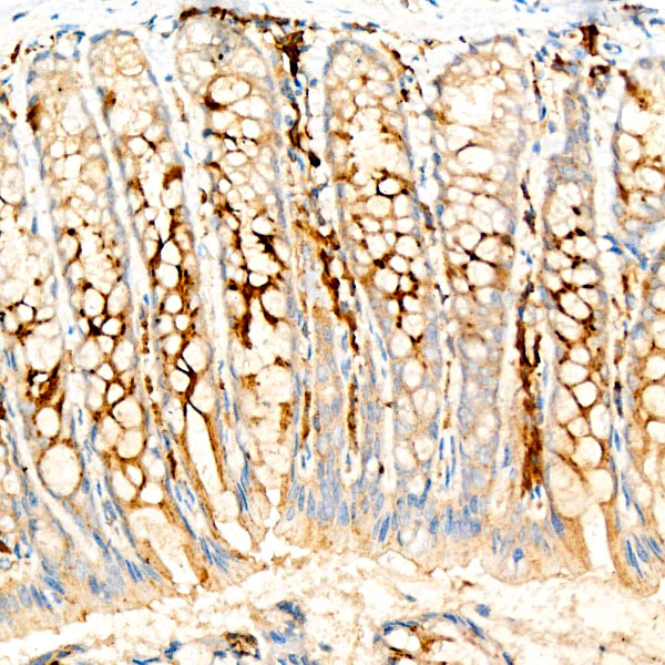 UBE2C Rabbit monoclonal antibody