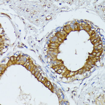 WNT1 Rabbit polyclonal antibody