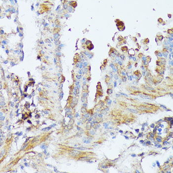 WNT1 Rabbit polyclonal antibody