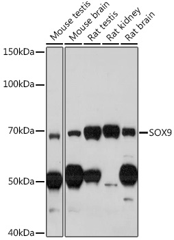 SOX9 Rabbit polyclonal antibody