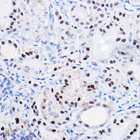 SOX9 Rabbit polyclonal antibody