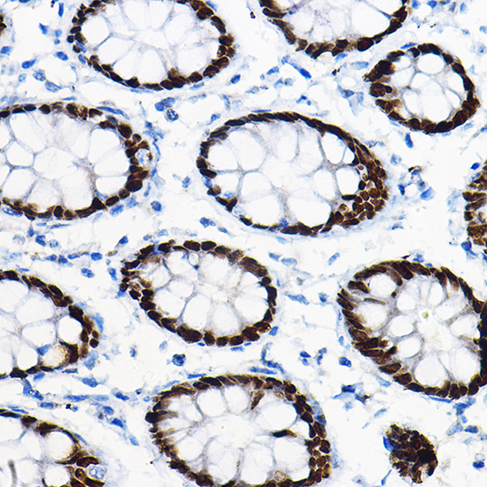 SOX9 Rabbit polyclonal antibody