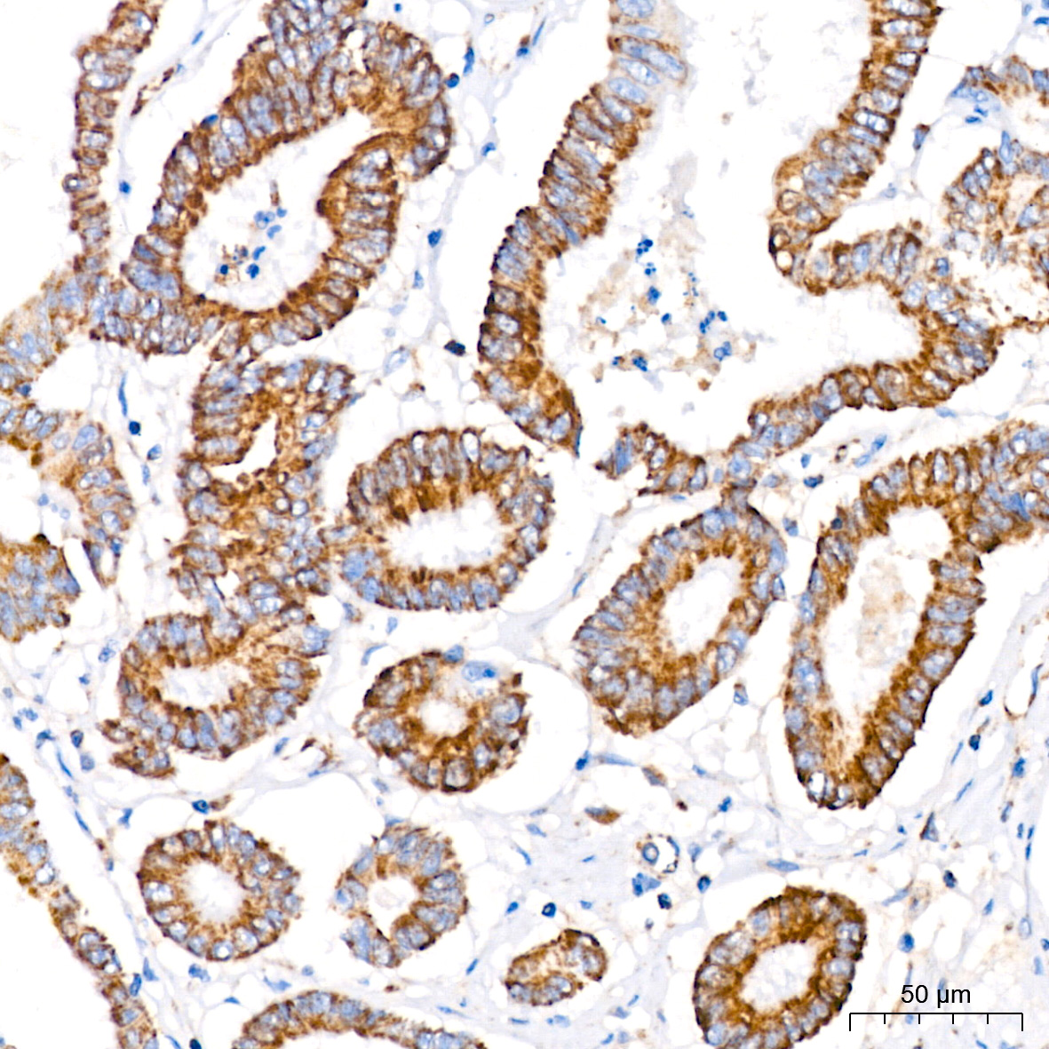 MTCO1 Rabbit monoclonal antibody