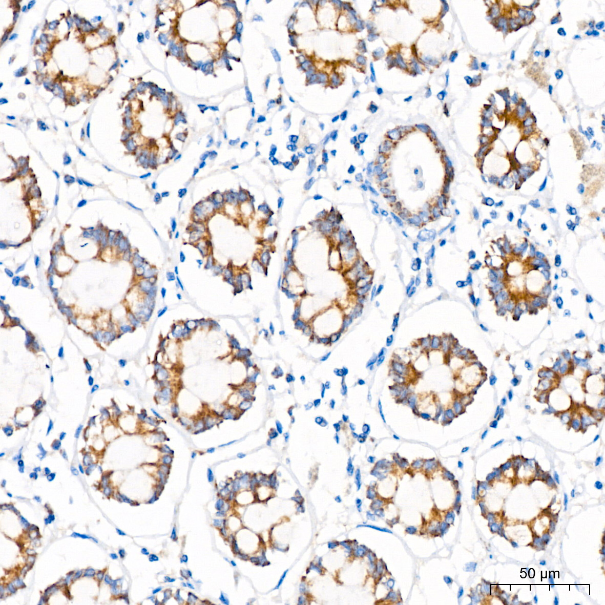 MTCO1 Rabbit monoclonal antibody
