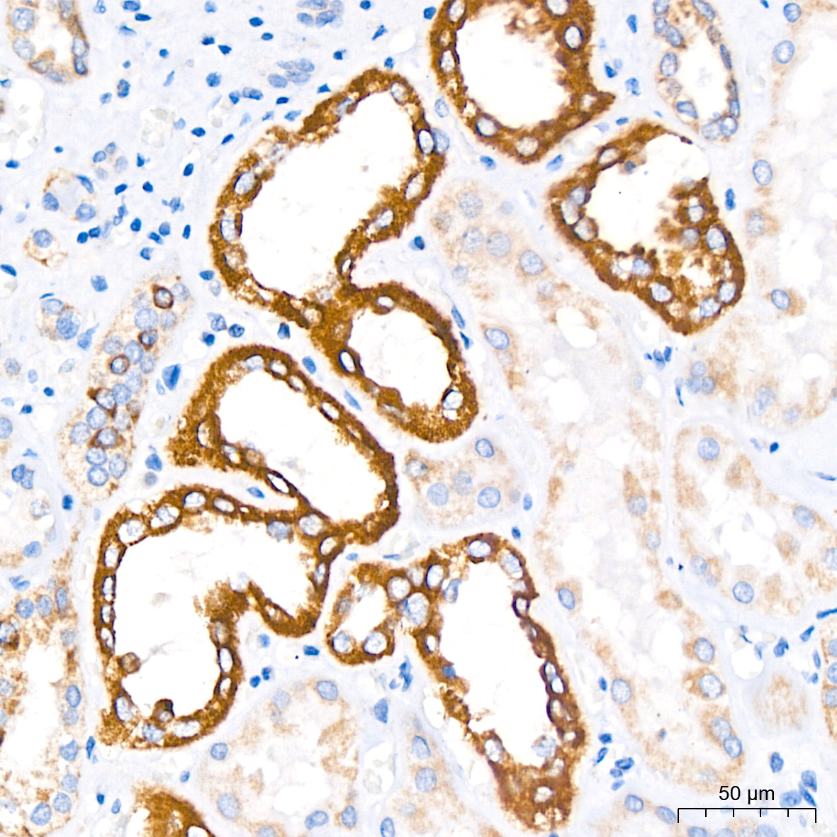 MTCO1 Rabbit monoclonal antibody