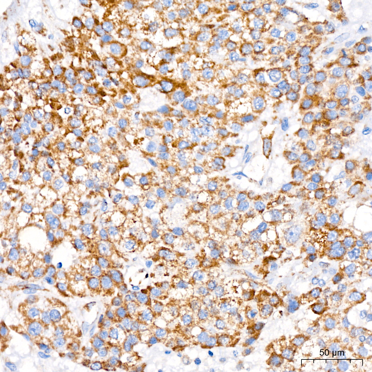 MTCO1 Rabbit monoclonal antibody
