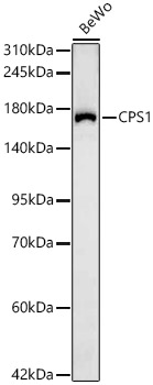 CPS1 Rabbit monoclonal antibody