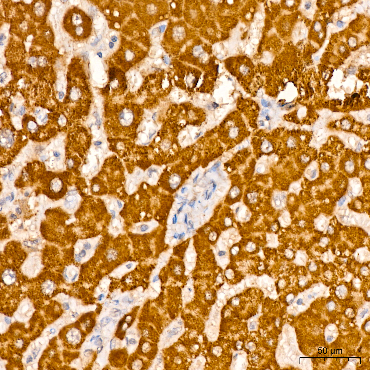 CPS1 Rabbit monoclonal antibody