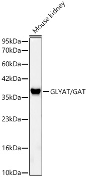 GLYAT/GAT Rabbit monoclonal antibody