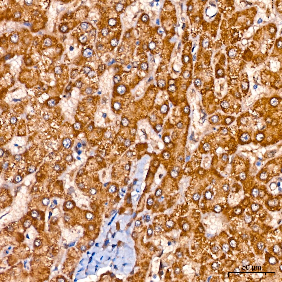 GLYAT/GAT Rabbit monoclonal antibody