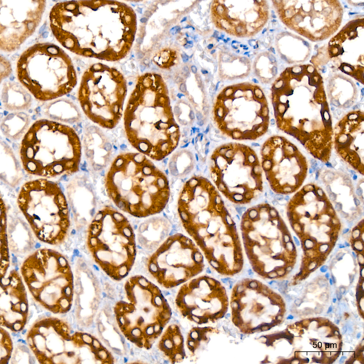 GLYAT/GAT Rabbit monoclonal antibody