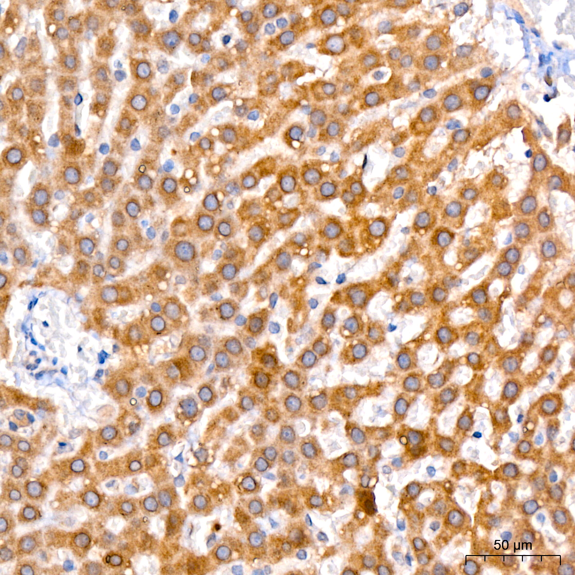 GLYAT/GAT Rabbit monoclonal antibody