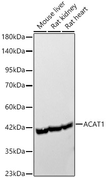 ACAT1 Rabbit monoclonal antibody