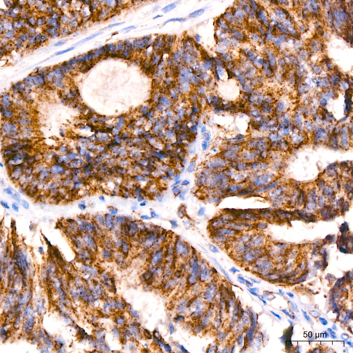 ACAT1 Rabbit monoclonal antibody