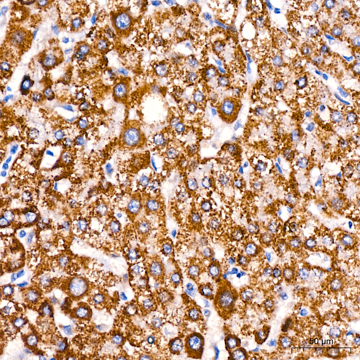 ACAT1 Rabbit monoclonal antibody