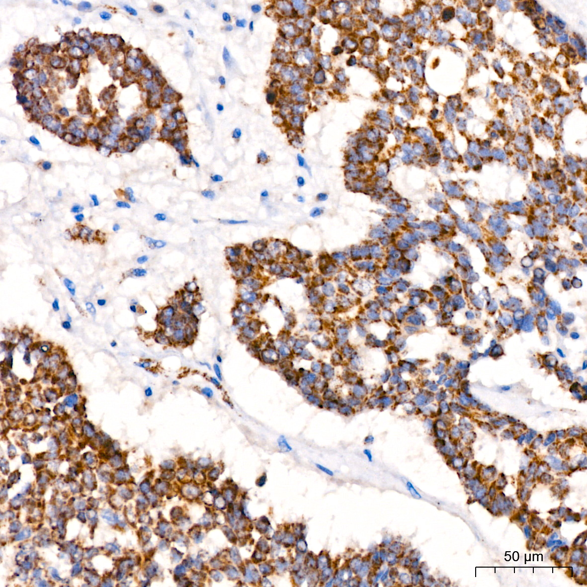 ACAT1 Rabbit monoclonal antibody