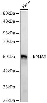 KPNA6 Rabbit monoclonal antibody