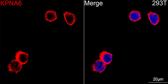KPNA6 Rabbit monoclonal antibody
