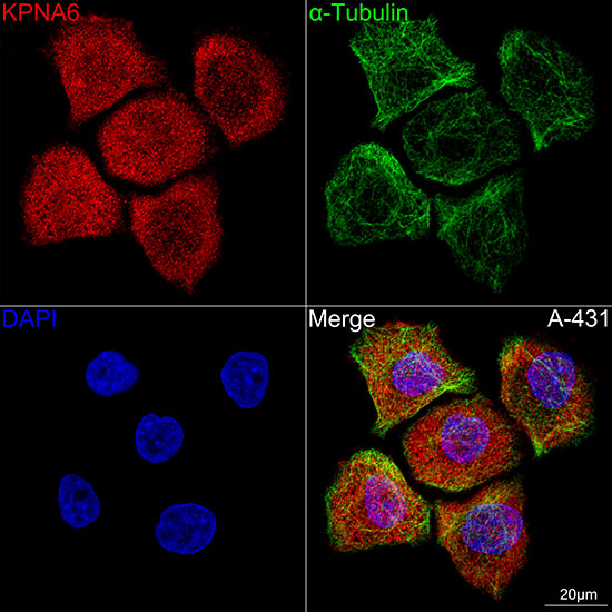 KPNA6 Rabbit monoclonal antibody