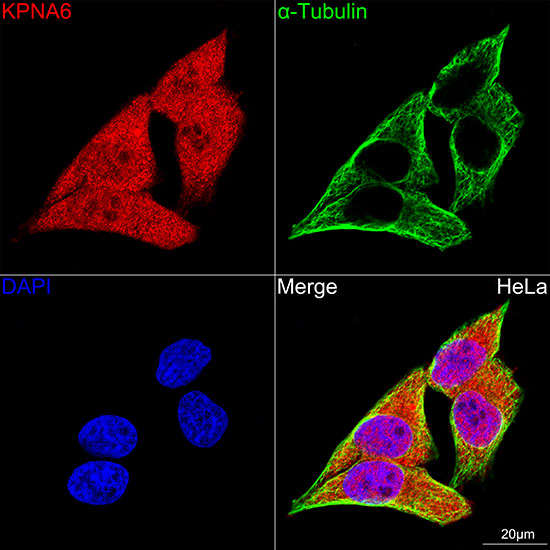 KPNA6 Rabbit monoclonal antibody