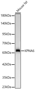 KPNA6 Rabbit monoclonal antibody