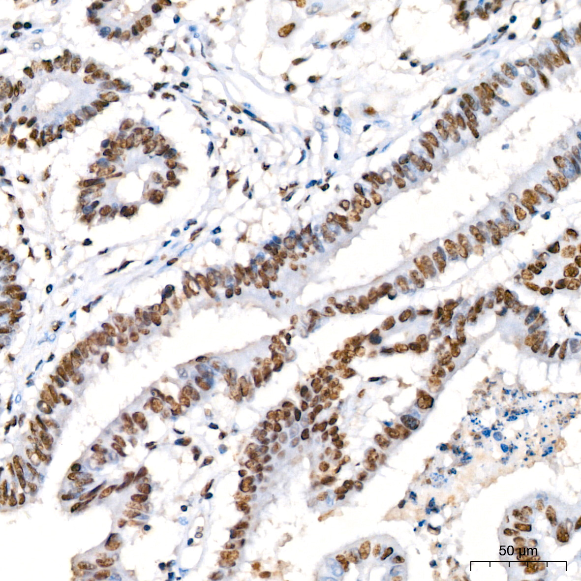 KPNA6 Rabbit monoclonal antibody