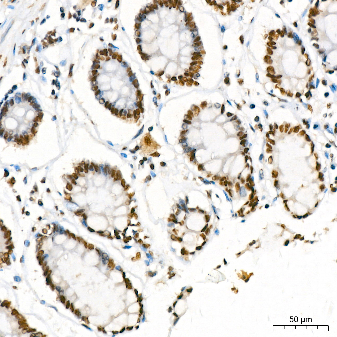 KPNA6 Rabbit monoclonal antibody