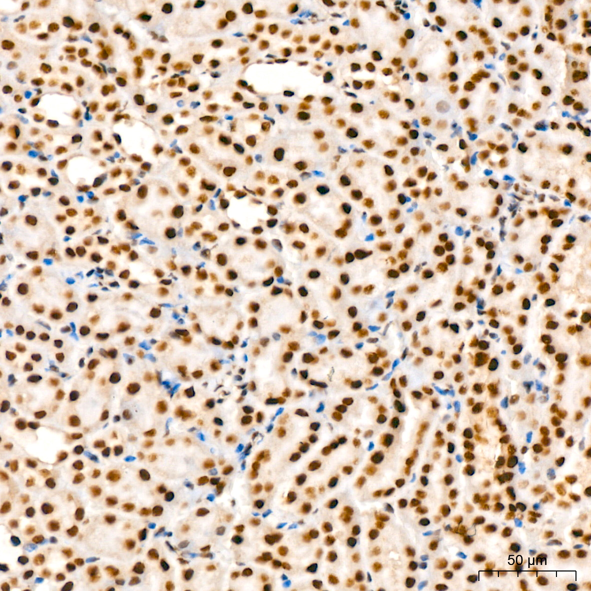 KPNA6 Rabbit monoclonal antibody