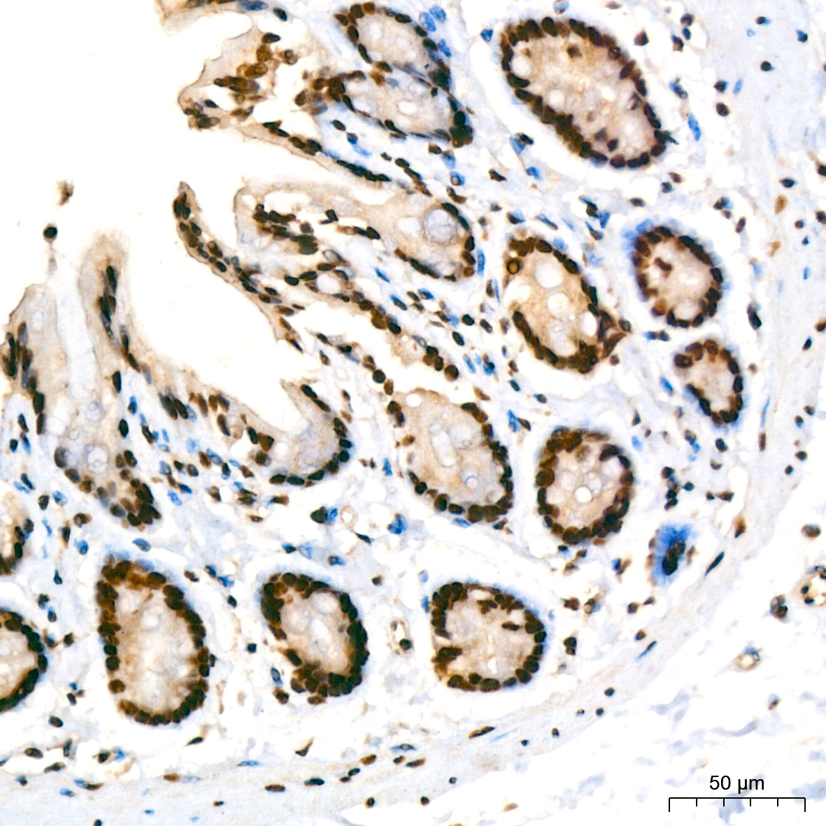KPNA6 Rabbit monoclonal antibody