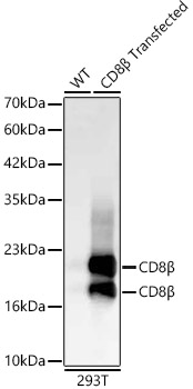 CD8B Beta Rabbit monoclonal antibody