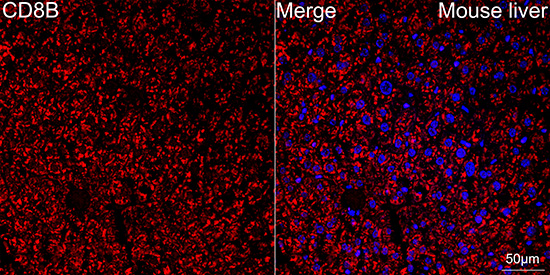 CD8B Beta Rabbit monoclonal antibody